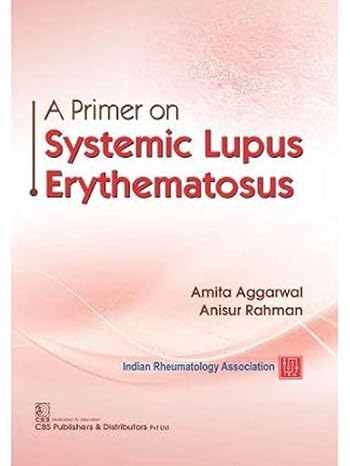 A Primer On Systemic Lupus Erythematosus (Pb 2021)